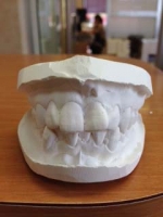 小原歯2